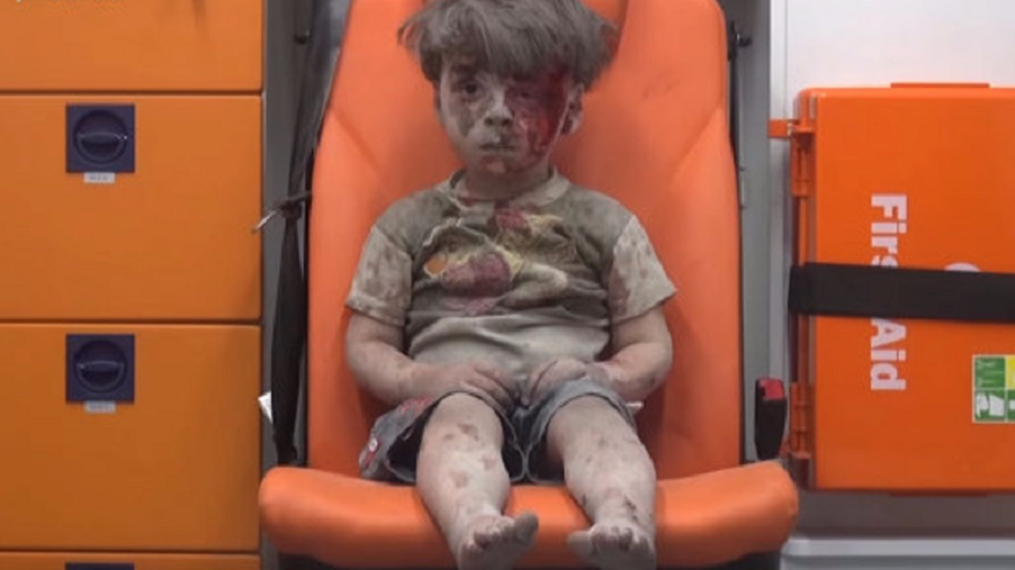Fotografia zraneného sýrskeho chlapca je známa po celom svete.