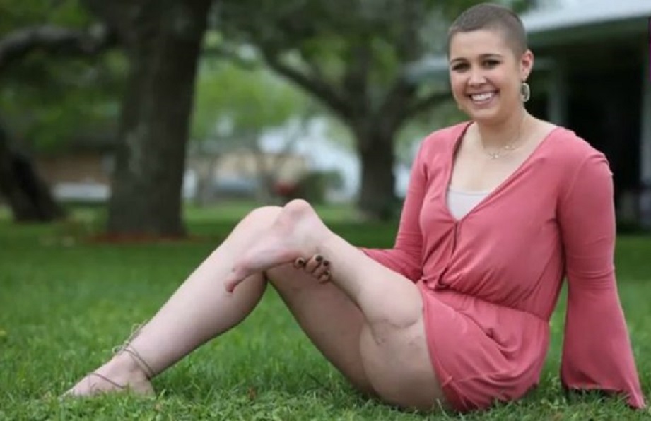 Jillian Williamsová musel bojovať o život, no nikdy netratila nádej a optimizmus.