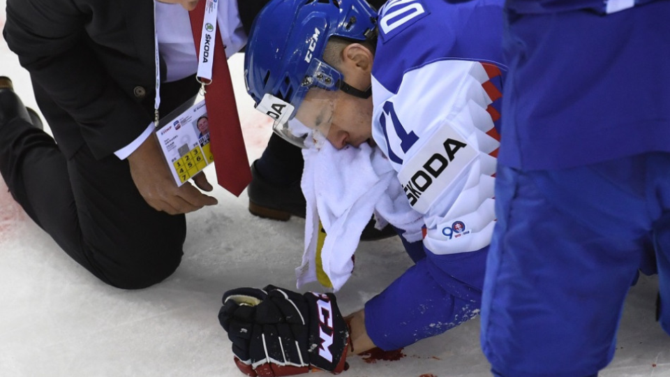 Na archívnej snímke zranený slovenský obranca Marek Ďaloga počas zápasu základnej A-skupiny Slovensko - Fínsko na 83. majstrovstvách sveta v ľadovom hokeji v Košiciach 11. mája 2019.