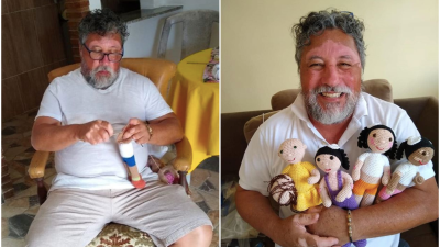 Dedko s vitiligom háčkuje bábiky pre deti s rovnakým ochorením. Aby neboli smutné, že sú iné