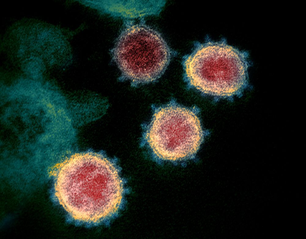 Na nedatovanej snímke Amerického národného inštitútu zdravia elektrónový mikroskop zachytáva nový koronavírus SARS-CoV-2, ktorý spôsobuje respiračné ochorenie COVID-19.