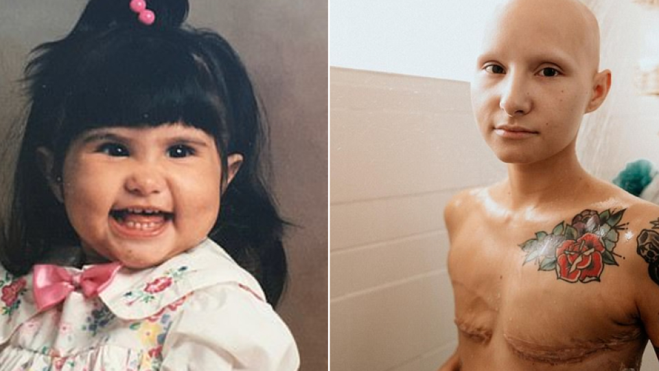 Na svojom Instagrame zdieľa to, ako sa zmierila s odstránením prsníkov a so životom bez vlasov.