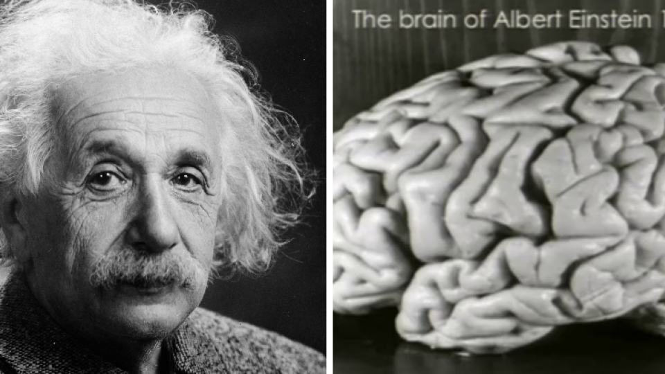Albert Einstein a originálna fotografia jeho mozgu z roku 1955.