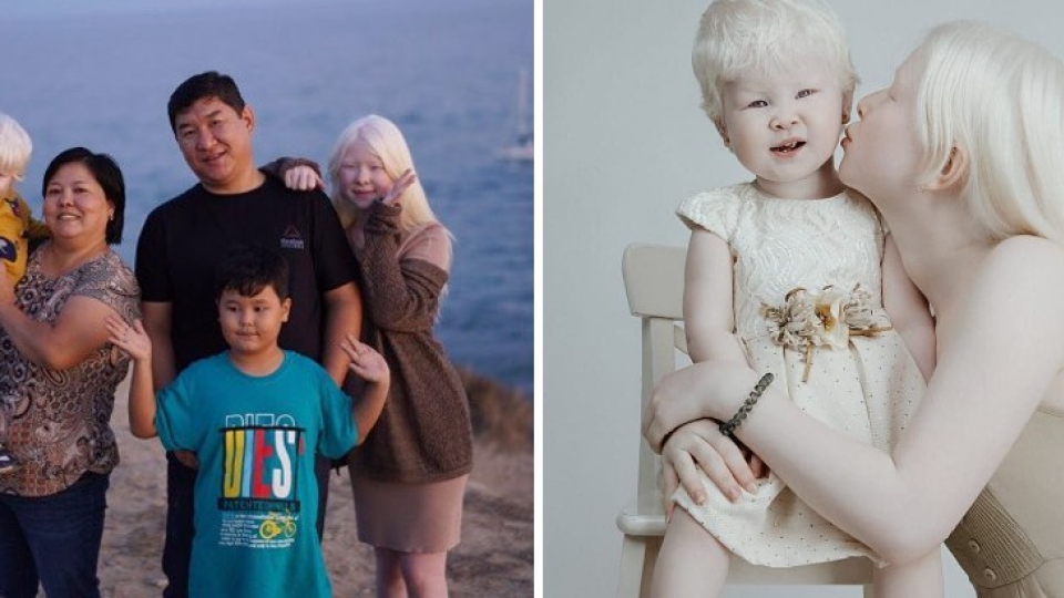 Sestry albínky sú si oporou.