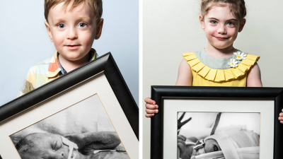 Dojímavé „predtým a potom“ fotografie predčasne narodených detí