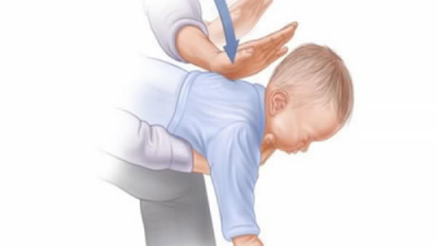 3 najdôležitejšie minúty: Ako postupovať, keď sa dieťa dusí?