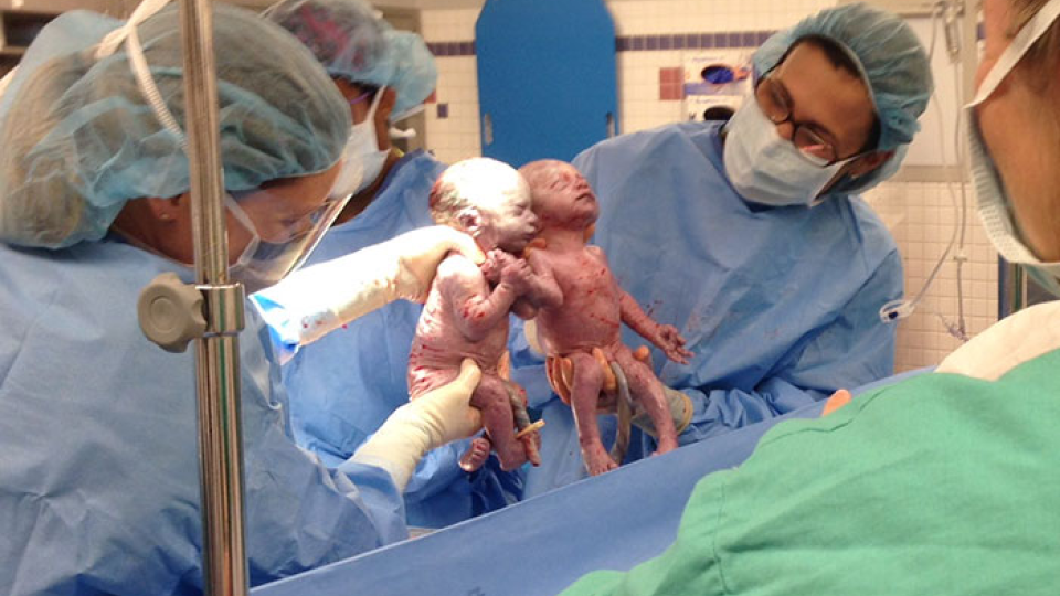 Dvojičky všetkých prekvapili tým, ako sa po narodení držali za ruky.
