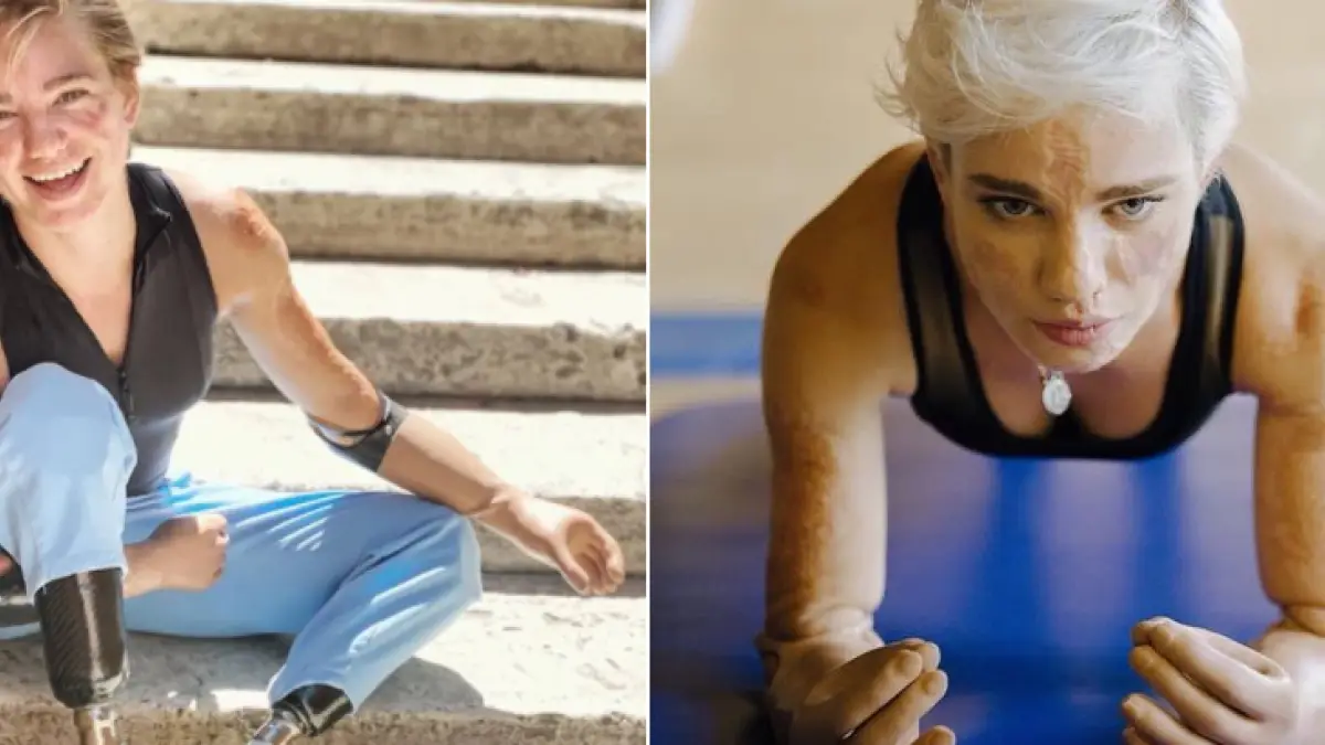 Talianska paralympijská šermiarka prišla ako 11-ročná o ruky aj nohy. Napriek tomu je dvojnásobnou zlatou víťazkou.