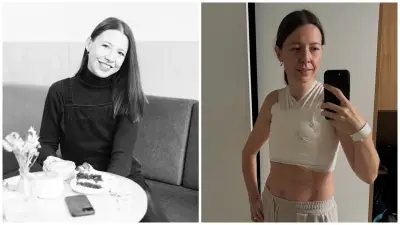Michaela Králiková podstúpila odstránenie prsníkov.